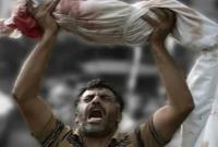 یک پزشک جراح: شاهد بی سابقه ترین جنایات علیه بشریت در غزه هستیم