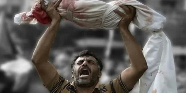 یک پزشک جراح: شاهد بی سابقه ترین جنایات علیه بشریت در غزه هستیم