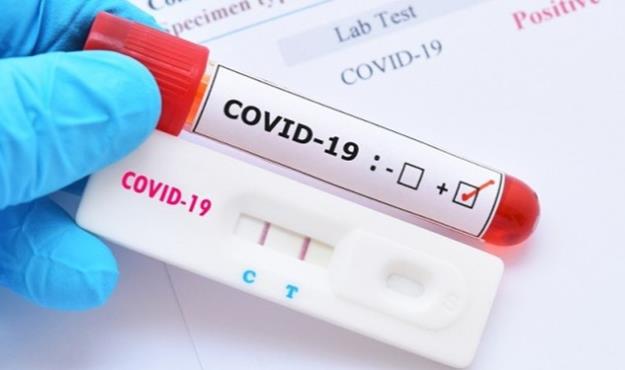 رشد ۶۶ درصدی مبتلایان کرونا در هرمزگان ظرف ۲۴ ساعت