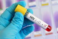 ثبت یک هزار و ۲۹۵ مورد ابتلا به ایدز در هرمزگان